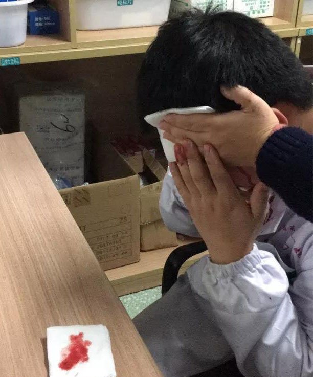 被砸傷的齊醫(yī)生.jpg