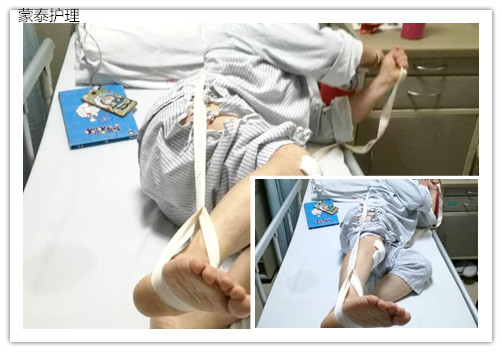 骨科膝关节牵引带.jpg